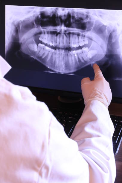 Best Emergency Treatment for Dental Infections or Abscesses in West Loch Estate, HI